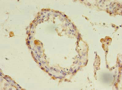 CSB-PA006237LA01HU