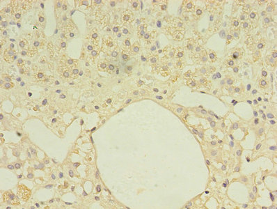 CSB-PA008575LA01HU