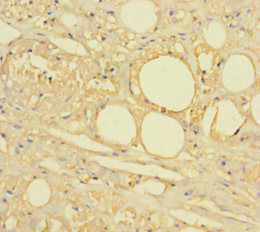CSB-PA010887LA01HU
