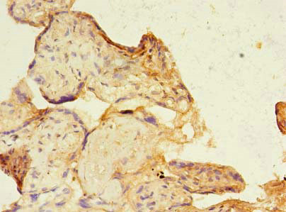 CSB-PA021300LA01HU
