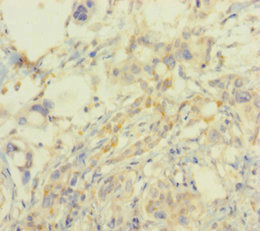 CSB-PA021799LA01HU