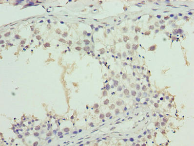CSB-PA023018LA01HU