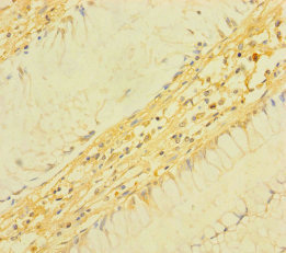 CSB-PA023620LA01HU