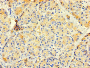 CSB-PA324640LA01HU