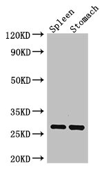 CSB-PA324640LA01HU