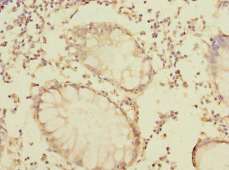 CSB-PA618886LA01HU