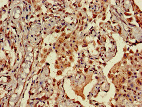 CSB-PA856441LA01HU