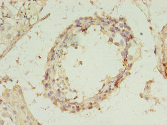 CSB-PA863931EA01HU