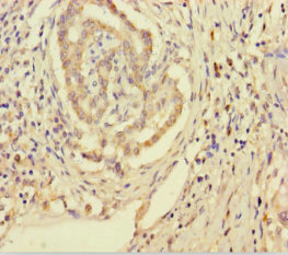 CSB-PA878920LA01HU