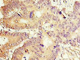 CSB-PA001169ESR2HU