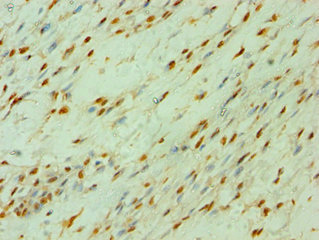 CSB-PA005574ESR1HU