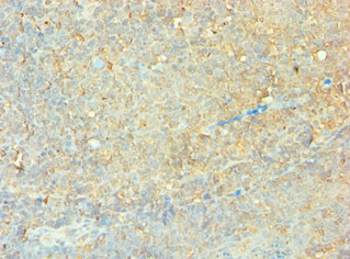CSB-PA005574ESR1HU
