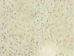 CSB-PA013773ESR1HU