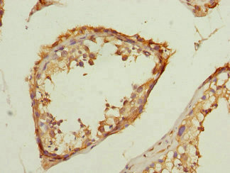CSB-PA023655ESR2HU