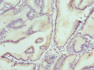 CSB-PA238099ESR2HU