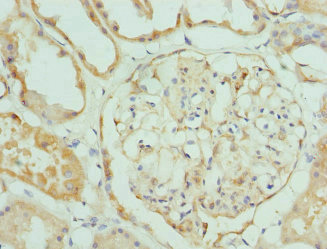 CSB-PA238099ESR2HU