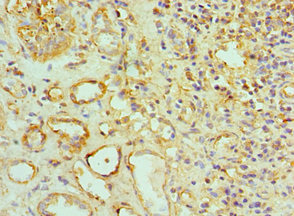 CSB-PA618983ESR2HU