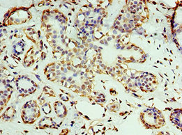 CSB-PA726123ESR1HU