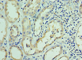 CSB-PA726123ESR1HU