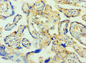 CSB-PA753711DSR1HU