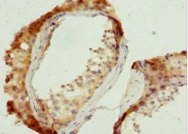 CSB-PA839401ESR2HU