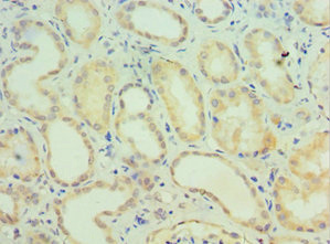 CSB-PA842636ESR1HU