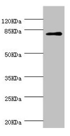 CSB-PA868352ESR2HU