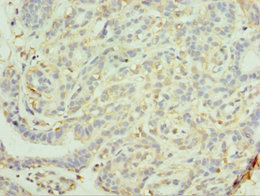 CSB-PA887003DSR2HU