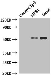 CSB-PA896542ESR1HU