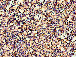 CSB-PA005679LA01HU