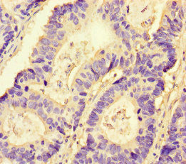 CSB-PA016092LA01HU