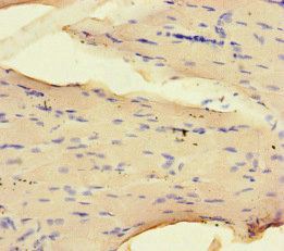 CSB-PA016092LA01HU