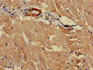 CSB-PA017522LA01HU