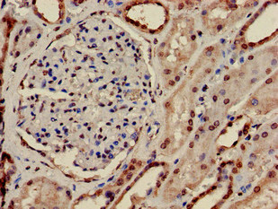 CSB-PA018779LA01HU