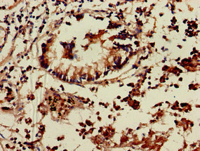 CSB-PA023998LA01HU