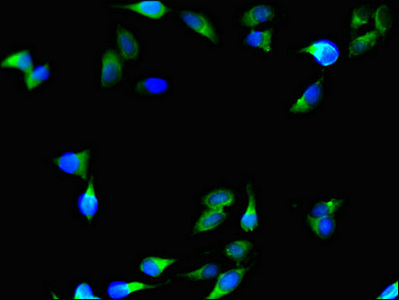 CSB-PA450719LA01HU