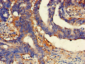 CSB-PA619859LA01HU