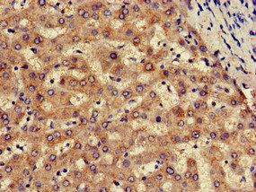 CSB-PA768239LA01HU