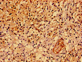 CSB-PA814245LA01HU