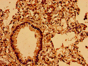 CSB-PA814245LA01HU