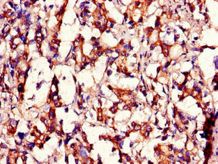 CSB-PA853101LA01HU