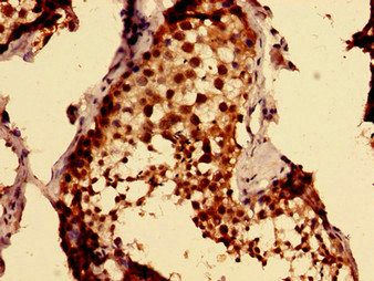 CSB-PA872420LA01HU