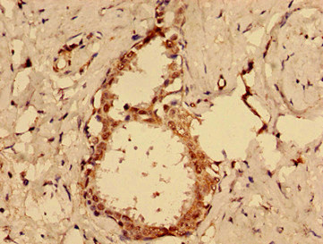 CSB-PA872420LA01HU
