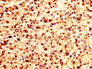 CSB-PA017809LA01HU