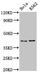 CSB-PA622995LA01HU