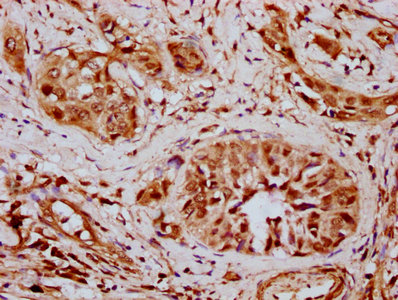CSB-PA846114LA01HU
