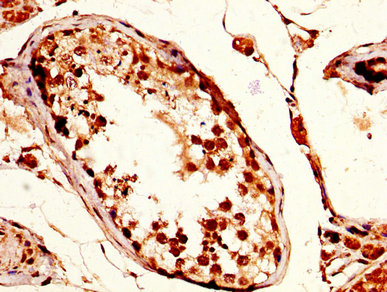 CSB-PA892151LA01HU