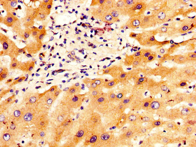 CSB-PA011897LA01HU
