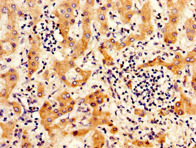 CSB-PA011897LA01HU