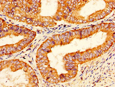 CSB-PA018754LA01HU